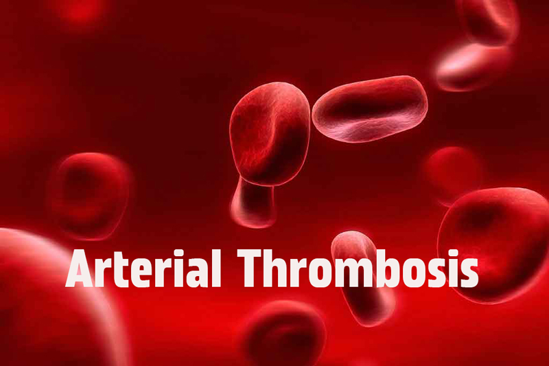 arterial thrombosis disease